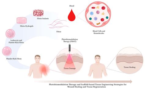  Fibrin: En Revolutionerande Biomaterial för Vävnadsregenerering och Läkemedelsleverans!